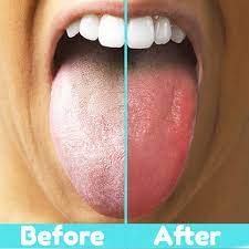 Tongue Scraper, Tongue Cleaning Brush