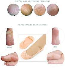 Anti Crack Full Length Silicone Foot Protector Moisturizing Socks for Foot-Care and Heel Cracks, heel pain.